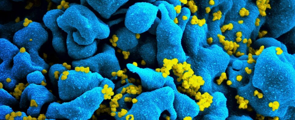 the method that allowed the cure of a seventh HIV