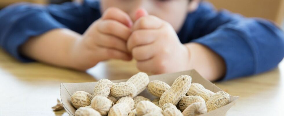 Australia launches gold standard treatment for peanut allergy in babies