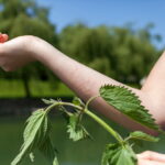 This seasonal vegetable would be ideal for relieving nettle stings