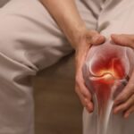 Towards the end of joint pain Revolutionary technology regenerates cartilage