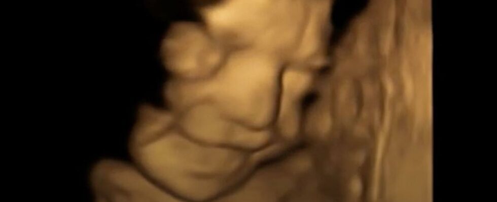 Baby Elena smiled in the womb killed with mother