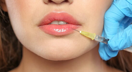 Hyaluronic acid injections effects dangers without prescription