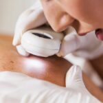 Sweden Skin cancer in young adults decreases a first in