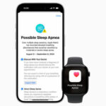 Apple Watch feature sleep apnea notifications released in Turkey