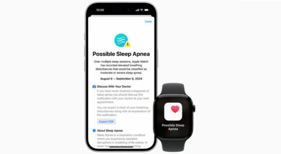 Apple Watch feature sleep apnea notifications released in Turkey