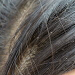 Heres why lice prefer your childs head over everyone elses