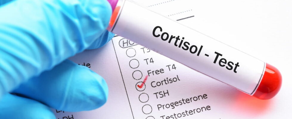 Hypertension the cortisol level should not be exceeded