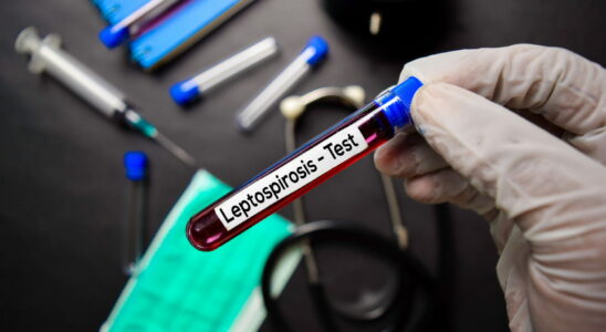 Leptospirosis symptom how do you catch it