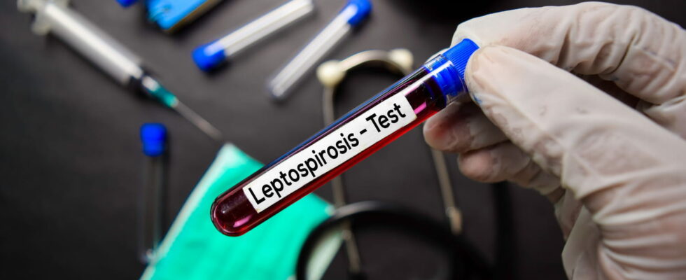 Leptospirosis symptom how do you catch it