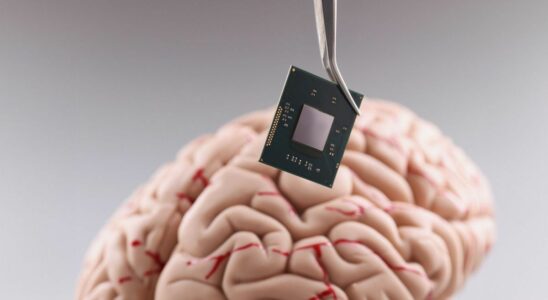 Neurotechnologies and neural privacy California finally protects your thoughts