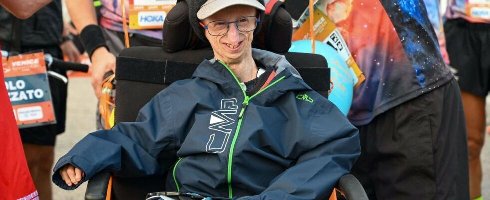 Sammy Basso oldest progeria patient died at 28 well beyond