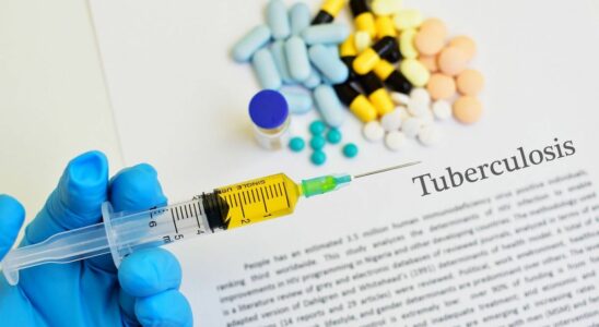 Record number of tuberculosis cases diagnosed in 2023 according to