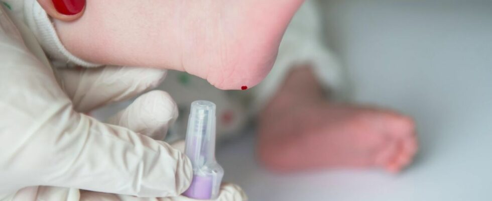 Sickle cell screening for all newborns in France from November