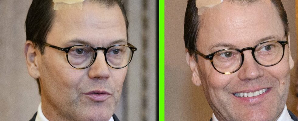 Thats why Prince Daniel has a plaster on his forehead