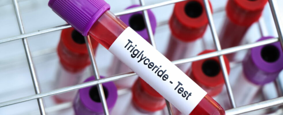 What is the normal triglyceride level at age 60