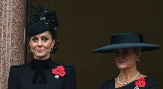 Why does Kate Middleton seem to have aged A doctor