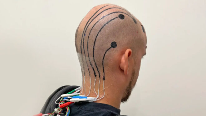 EEG