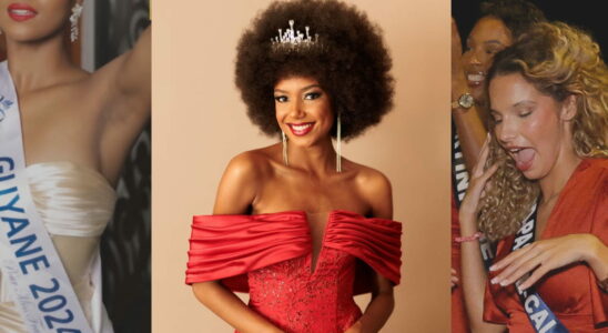 Miss France 2025 big feet afro cut advanced age The