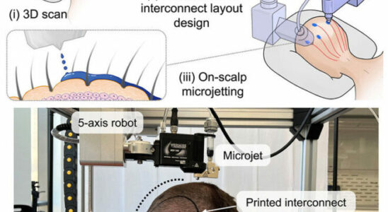 Researchers develop proprietary alternative to EEG caps