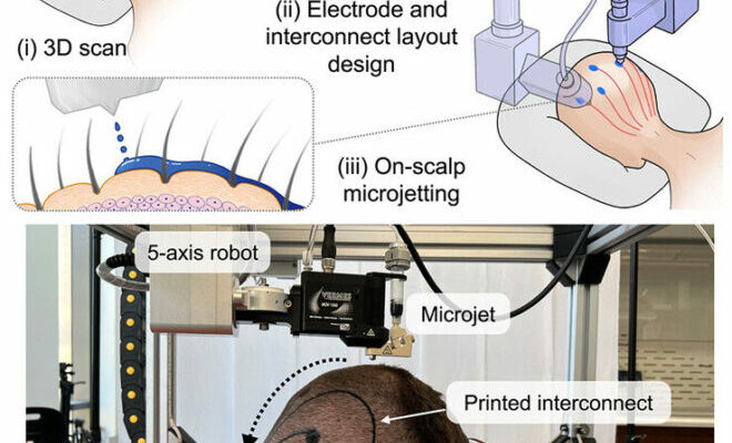 Researchers develop proprietary alternative to EEG caps