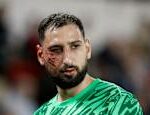 The opponents shoe cut Gianluigi Donnarummas face bloodily the