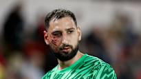 The opponents shoe cut Gianluigi Donnarummas face bloodily the