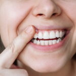 How to delay tooth loss as you age