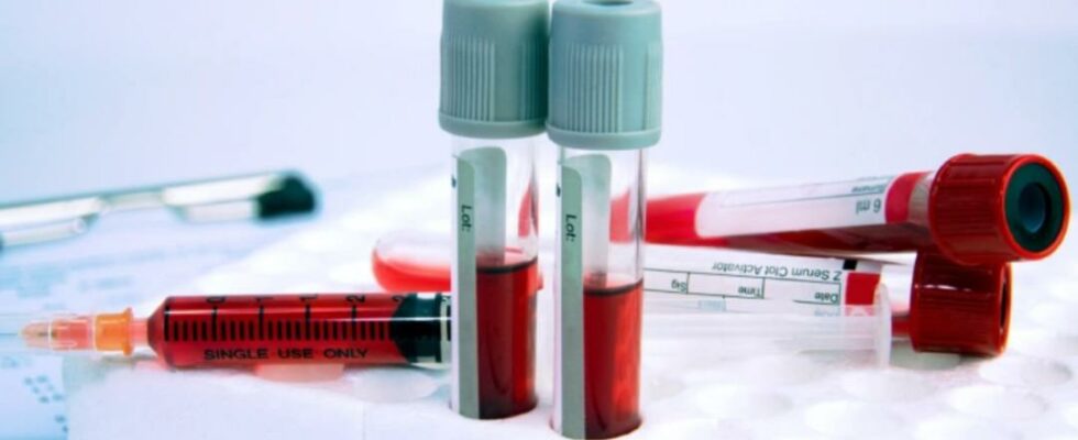 If this value in the blood analysis is not fixed