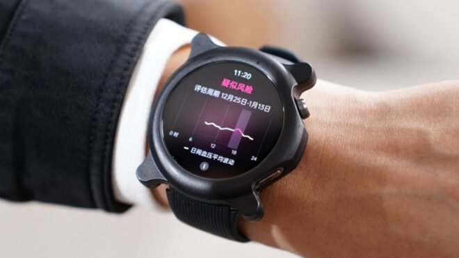 OPPO Watch X2 smart watch model will be able to