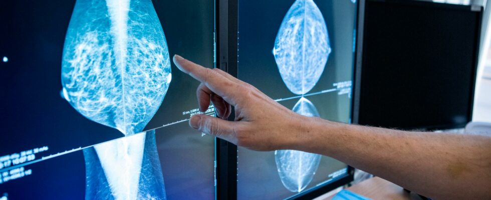 Success when AI is looking for breast cancer