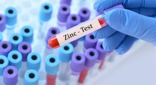 What is the normal level of zinc in the blood