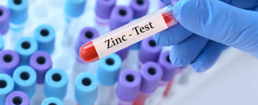 What is the normal level of zinc in the blood