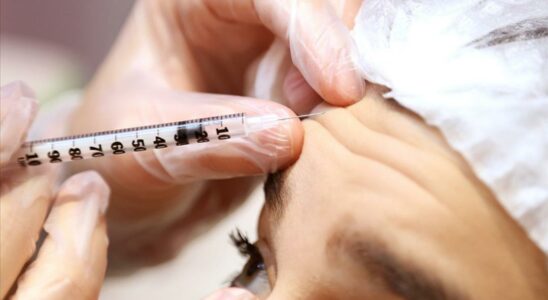 Is botox effective in physical therapy Is it useful in