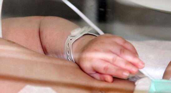 It is seen in newborn babies Attention to the risk